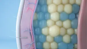 CoolSculpting® Elite targets and freezes fat