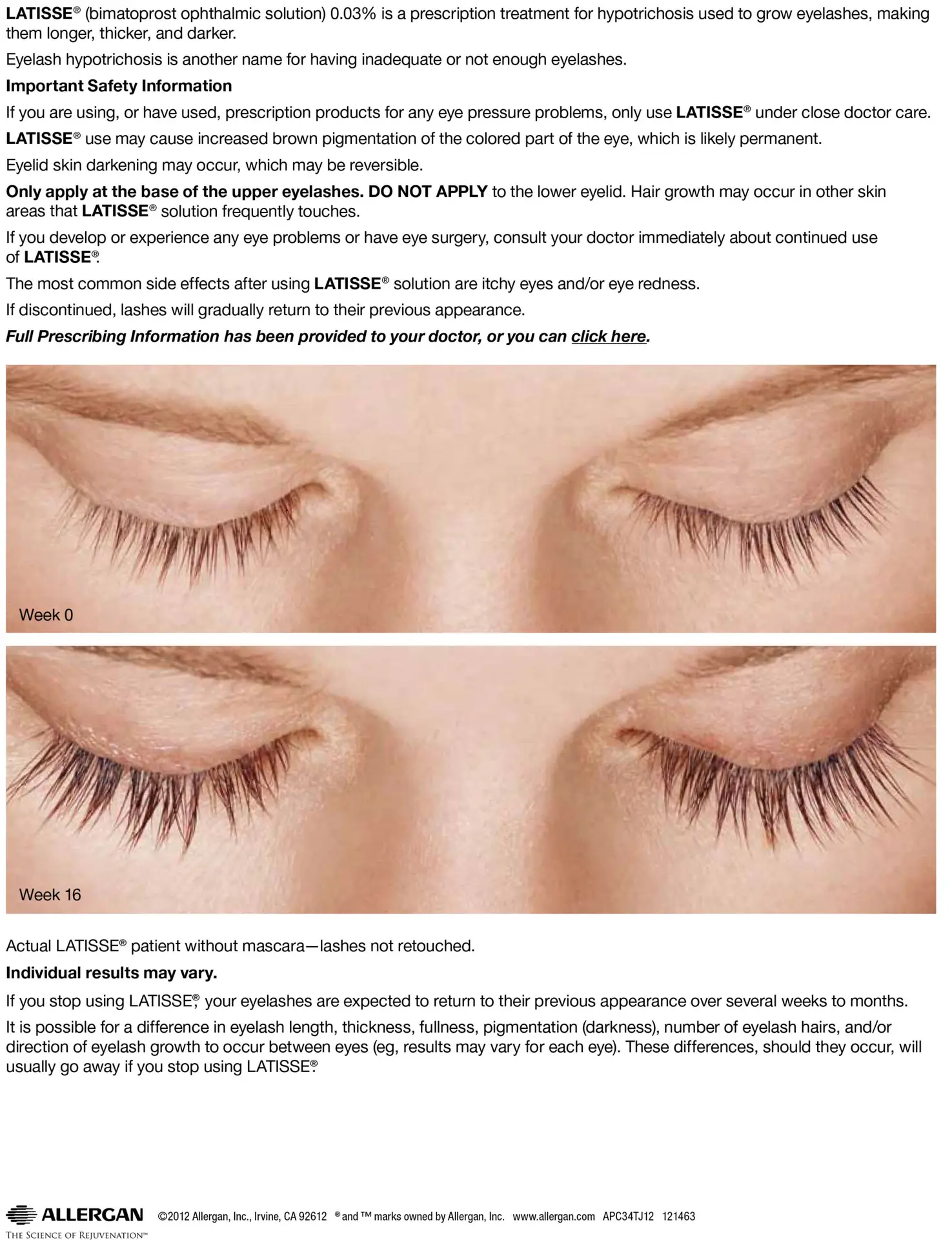 Latisse can give you fuller, and longer lashes starting in 4 weeks. Offered by La Bella Vita Medi Spa in Rocklin, CA