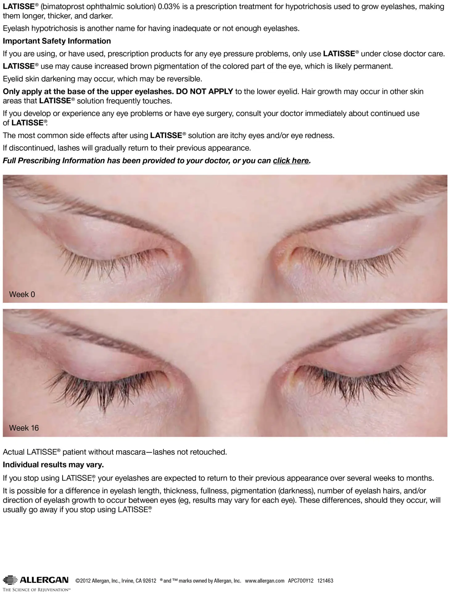 Latisse Clinical Patient Week 0 and Week 16