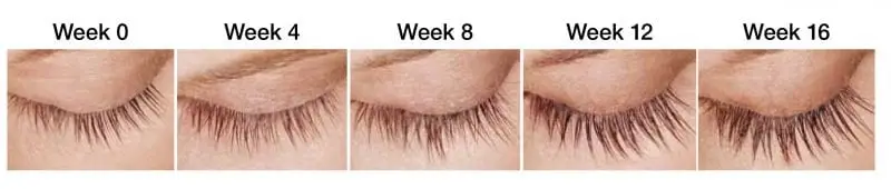 Latisse 16 week progression