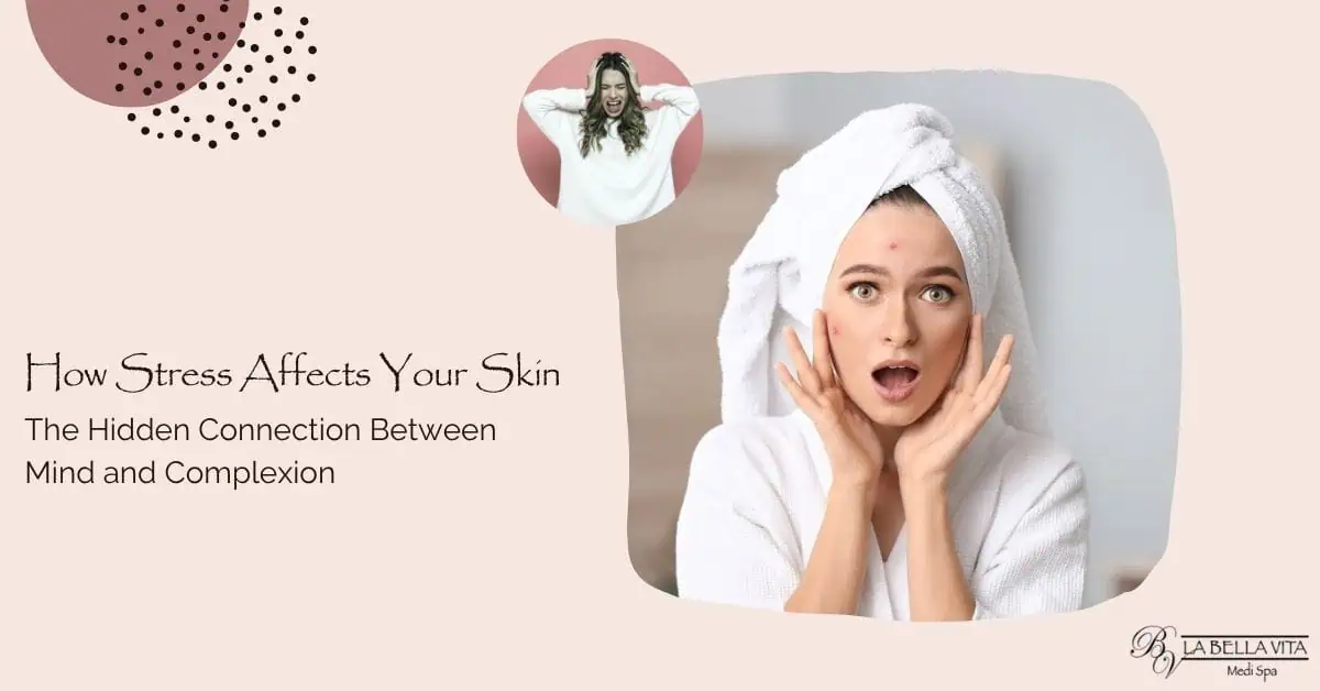 How Stress Affects Your Skin The Hidden Connection Between Mind and Complexion blog post image